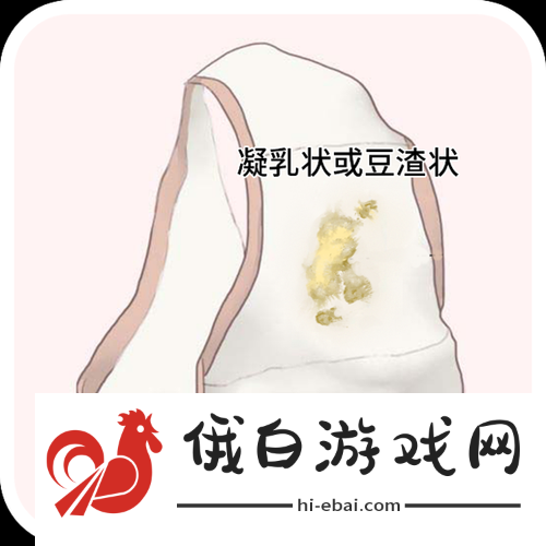 女生次数多了会有豆腐渣分泌物吗